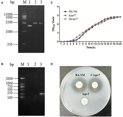 Riemerella anatipestifer Type IX Secretion System Is Required for Virulence and Gelatinase Secretion